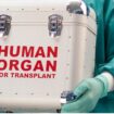 Ingatan dan kepribadian diwarikan ke penerima transplantasi