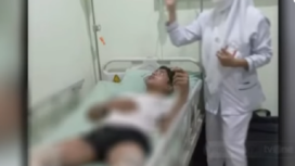 Korban bernama SS, terbaring dirumah sakit untuk mendapatkan perawatan luka bakar 38 % persen akibat dianiaya oleh tamu pondok,, Senin 16 Desember 2024. tangkap layar video youtube@TVOne