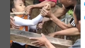 Bocah Renan, 5 tahun, berhasil diselamatkan setelah terperosok ke dalam sumur sedalam sekitar 5 meter. Evakuasia dilakukan oleh tim BPBD Sumenep bersama warga. instagram@kominfosumenep