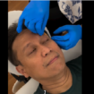 Menteri Kesehatan Budi Gunadi Sadikin mendapat perawatan di RSCM, untuk menjahit luka di pelipis kanan 2.5, cm akibat terpeleset di kamar mandi, Minggu 2 Februari 2025. Tangkap Layar Video Instagram@bgsadikin