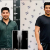 Alfonso Flores adalah seorang mahasiswa kedokteran di Texas, Amerika Serikat. Dia rela merogoh koceknya Rp 1 miliar untuk menambah tinggi badannya 5 cm, dari 180 cm menjadi 185 cm. Operasi dilaporkan berjalan baik. Instagram@bagikertas.id