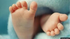 Bayi dengan tiga DNA yakni satu pria dan dua wanita