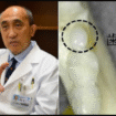 Tim peneliti dipimpin Dr. Katsu Takahashi di Medical Research Institute Kitano Hospital menemukan obat penumbuh gigi alami, akan bisa digunakan tahun 2030. Foto: Istimewa