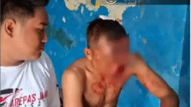 Seorang warga desa jadi korban pengeroyokan, akibat meludahi Kades Subandi di Desa Kedungboto terjadi pada Senin, 23 Februari 2026, siang hari. Foto: Instagram@pasuruankekinian